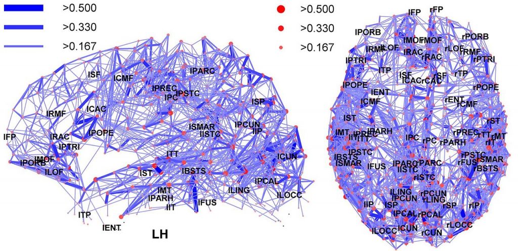 Die neuronalen Netze im menschlichen Hirn (Foto: Wikimedia - siehe Bildnachweis unten)